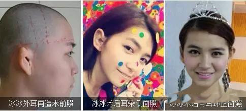 【励志】90后耳畸形少女的蜕变人生！