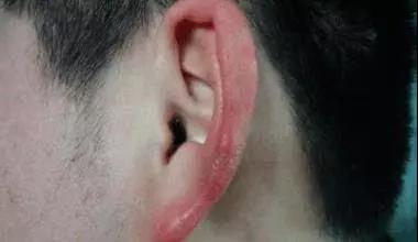 寒冷冬季，四点告诉你为什么要保护我们的耳朵